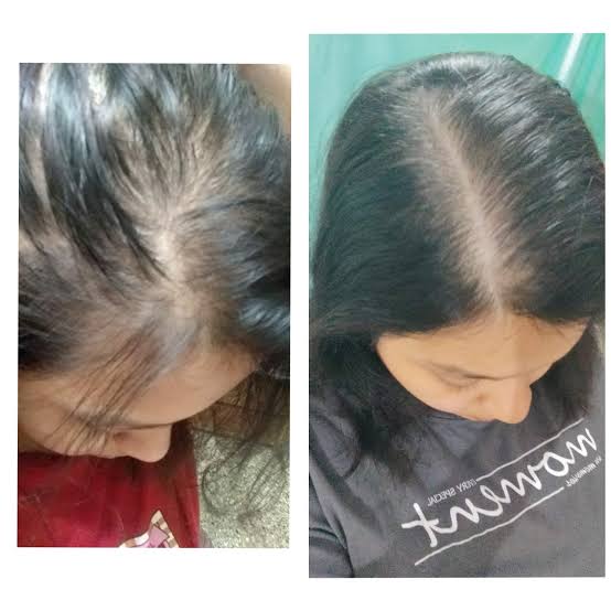 Organic Flex Seed Gel for Hairs ( Ready to Use)